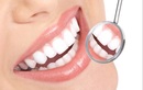 Протезирование зубов (ортопедия) — Стоматология СтартДент – Цены - фото