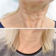 ORIENTAL - фото 2