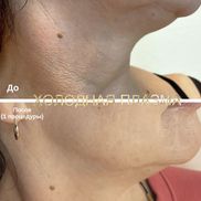 INTUITION - фото 3