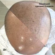 INTUITION - фото 2