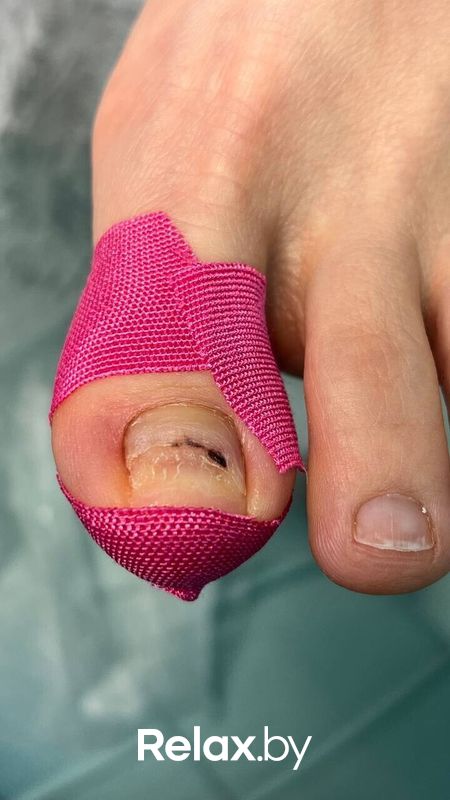 Подология Студия подологии и эстетики  Moipodolog (Мой подолог) - фото 7866250