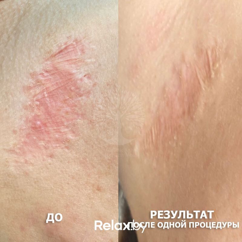 Эстетический камуфляж Студия красоты «INTUITION (Интуишн)» - фото 7838251