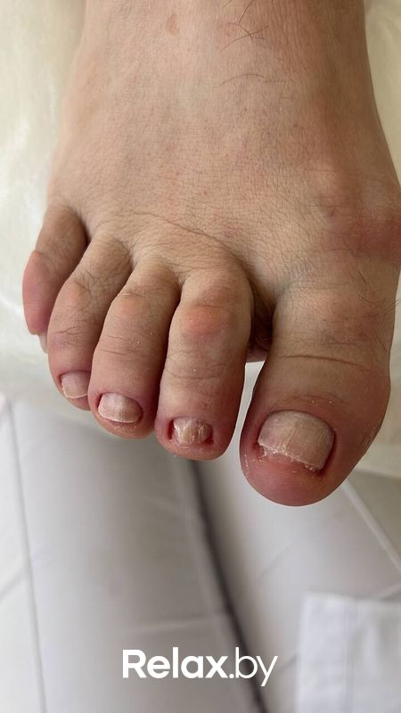 Подология Студия подологии и эстетики  Moipodolog (Мой подолог) - фото 7866727