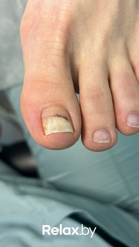 Подология Студия подологии и эстетики  Moipodolog (Мой подолог) - фото 7866253