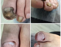 Студия подологии PodoArt (ПодоАрт), Примеры работ - фото 1