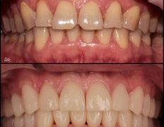 null «Стоматология в "Изумрудном"», Примеры работ - фото 2