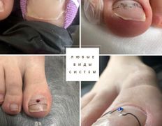 Центр подологии и эстетики Чистая стопа, Подология - фото 1