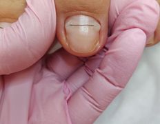 Салон красоты Шевелюра, Подология - фото 2