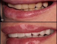 null «Стоматология в "Изумрудном"», Примеры работ - фото 6