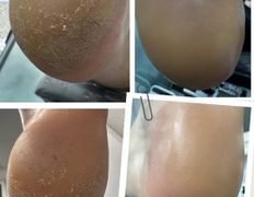 Центр подологии и эстетики Чистая стопа, Подология - фото 5