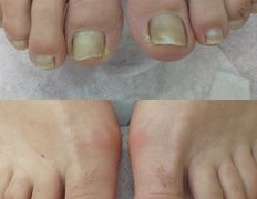 Салон красоты Шевелюра, Подология - фото 11