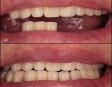 null «Стоматология в "Изумрудном"», Примеры работ - фото 7