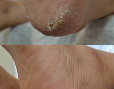 Салон красоты Шевелюра, Подология - фото 9