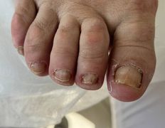 Студия подологии и эстетики  Moipodolog (Мой подолог), Подология - фото 11