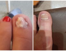 Студия подологии PodoArt (ПодоАрт), Галерея - фото 4