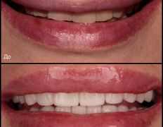 null «Стоматология в "Изумрудном"», Примеры работ - фото 4