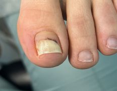 Студия подологии и эстетики  Moipodolog (Мой подолог), Подология - фото 1