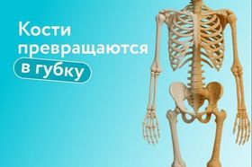 «Тихий» остеопороз: почему кости превращаются в губку, как избежать переломов и когда нужна госпитализация