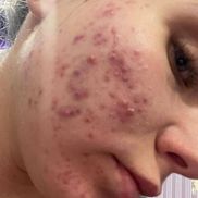 Косметический кабинет Юлии Смирновой - фото 3