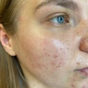 Косметический кабинет Юлии Смирновой - фото 6