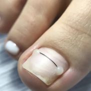 СТОПА - фото 4