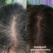 INTUITION - фото 3