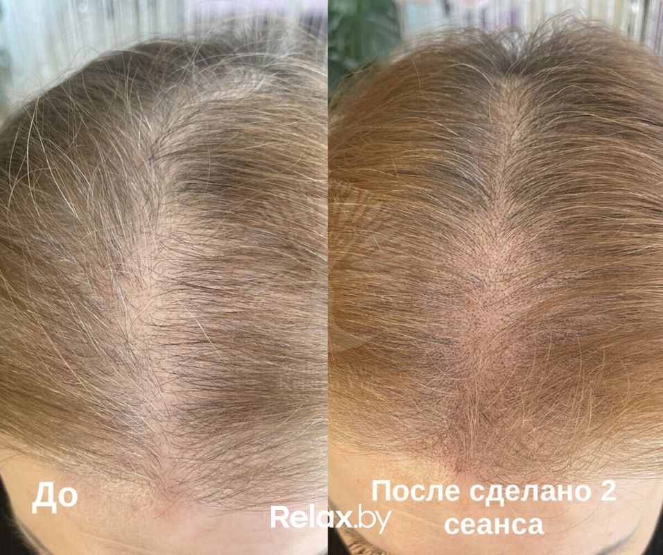 Трихопигментация Студия красоты «INTUITION (Интуишн)» - фото 7838254