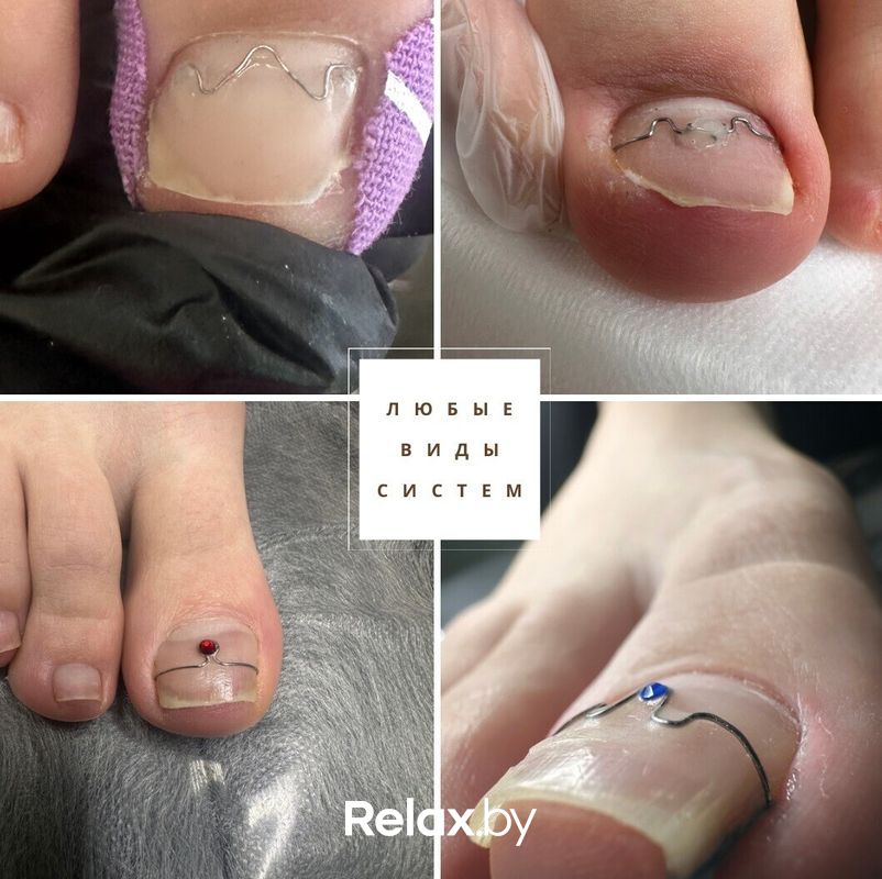 Подология Центр подологии и эстетики «Чистая стопа» - фото 7877402