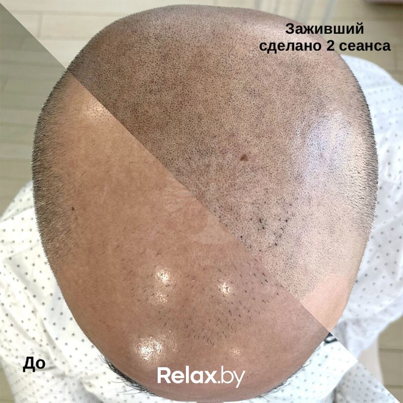 Трихопигментация Студия красоты «INTUITION (Интуишн)» - фото 7838257