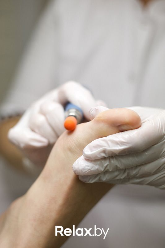 Прием подолога Центр здоровой стопы «AeroPod (АэроПод)» - фото 7810988