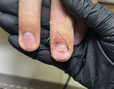 Студия подологии и эстетики  Moipodolog (Мой подолог), Подология - фото 6