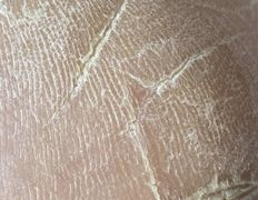 Эстетический центр Grandessa (Грандесса), Педикюр ADN - фото 3