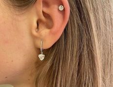 Косметический кабинет Медикал Бьюти на Грушевке, Примеры работ - фото 20