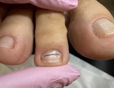 null Центр подологии и эстетики Ольги Дударевич, Примеры работ - фото 3