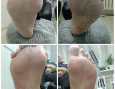 Студия подологии PodoArt (ПодоАрт), Галерея - фото 5