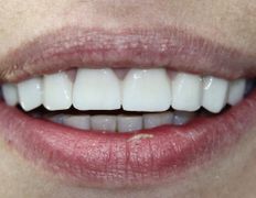 Стоматология Евро-Стом, Галерея - фото 18