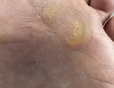 Студия подологии и эстетики IloNails studio (ИлоНеилс студио), Подология - фото 1