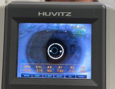 null Кабинет офтальмолога FOCUS (ФОКУС), Галерея - фото 2