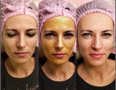 Студия красоты Valeria Studio (Валерия Студия), Уход за лицом - фото 6