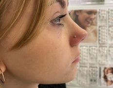 Косметический кабинет Медикал Бьюти на Грушевке, Примеры работ - фото 17