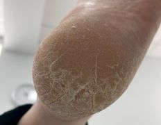 Студия подологии и эстетики IloNails studio (ИлоНеилс студио), Подология - фото 5