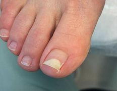 Студия подологии и эстетики  Moipodolog (Мой подолог), Подология - фото 3