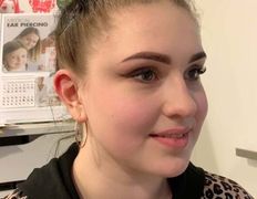 Косметический кабинет Медикал Бьюти на Грушевке, Примеры работ - фото 2