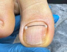 null Центр подологии и эстетики Ольги Дударевич, Примеры работ - фото 2