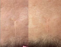 Студия красоты INTUITION (Интуишн), Эстетический камуфляж - фото 4