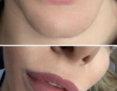 Салон красоты La Stella (Ла Стелла), Перманентный макияж - фото 17