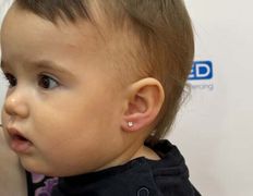 Косметический кабинет Inverness (Инвернесс), Прокол ушей - фото 8