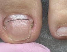 null Центр подологии и эстетики Ольги Дударевич, Примеры работ - фото 4