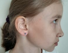 Эстетический центр Grandessa (Грандесса), Прокол ушей и пирсинг - фото 3