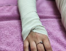 Студия массажа и коррекции фигуры Izumrud (Изумруд), Виски-пеленание - фото 14